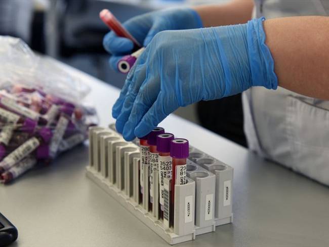 Rusia dice tener el primer antiviral efectivo contra el coronavirus. Foto: Getty Images