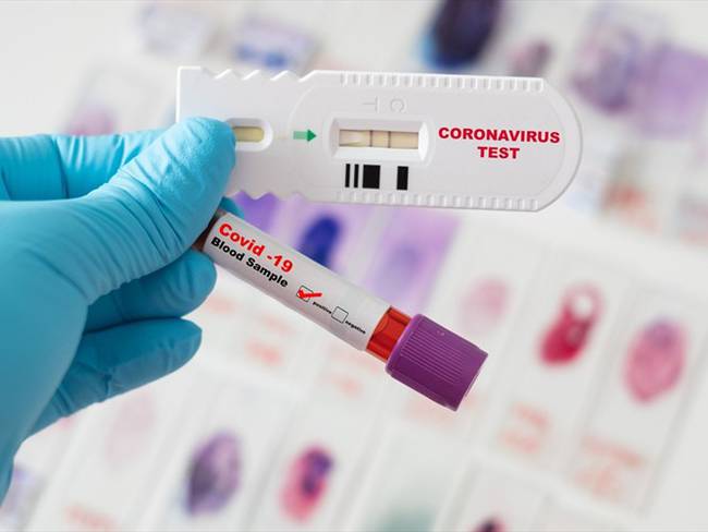 En este momento no existe ninguna prueba que reemplace al test molecular de coronavirus: Gabriela Delgado. Foto: Getty Images / JACKYENJOYPHOTOGRAPHY