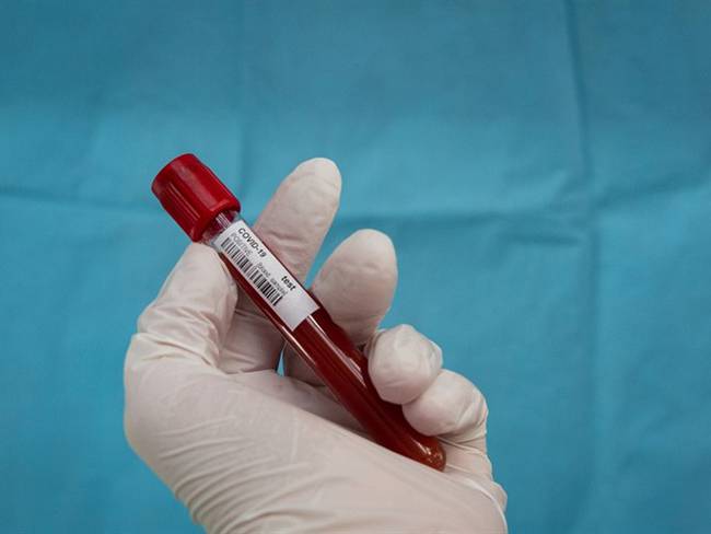 Ciertos tipos de sangre serían más fuertes al virus, mientras que otros estarían predispuestos a generar complicaciones.. Foto: Getty Images