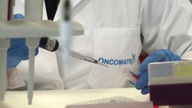 La empresa biofarmaceútica española Oncomatryx realizará ensayos clínicos en hospitales españoles y de Estados Unidos de su fármaco contra el cáncer basado en un anticuerpo conjugado.