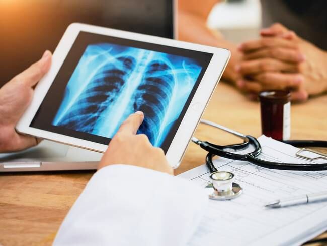 Cáncer de pulmón: ¿qué factores aumentan el riesgo de padecerlo?