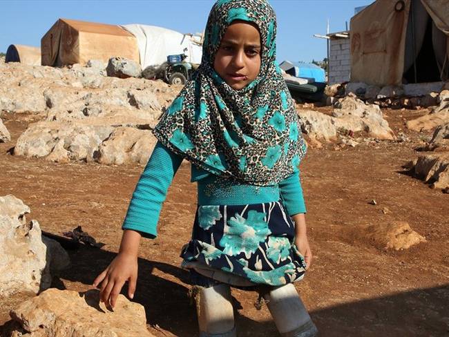 La niña siria que usa latas en lugar de prótesis. Foto: Agencia Anadolu
