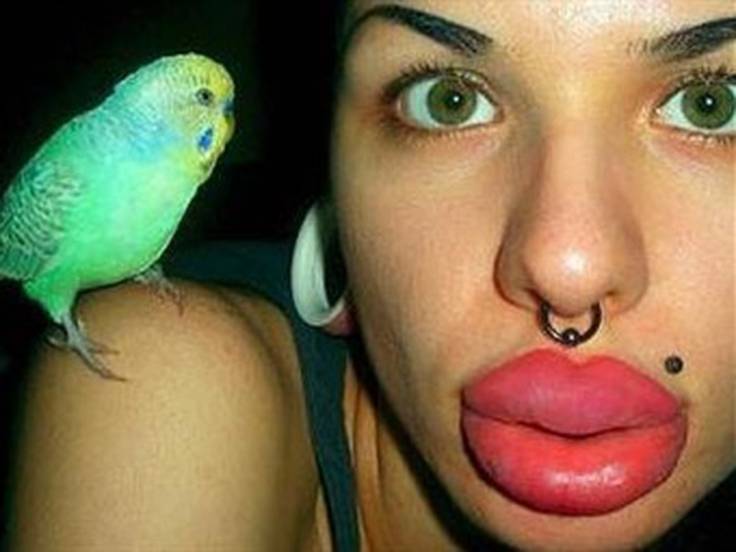 la mujer con los labios más grandes del mundo se ha operado 100 veces