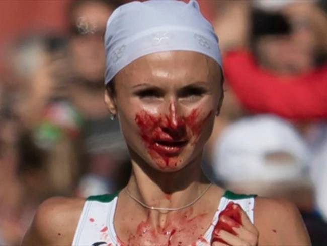 Volha Mazuronak con la cara ensangrentada en la maratón de Berlín. Foto: Associated Press - AP
