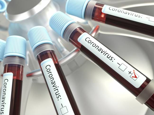 La magnitud del problema del Coronavirus no será diferente a una gripa: Ángel Gil