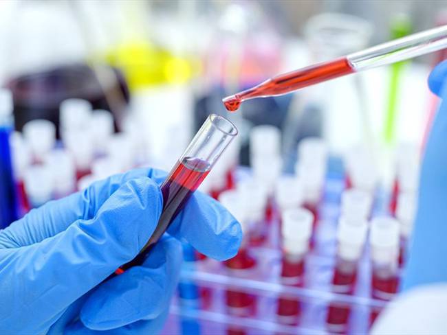 quien donó las células madre tiene una mutación en sus genes que le permite a los glóbulos blancos inhibir el VIH. Foto: Getty Images