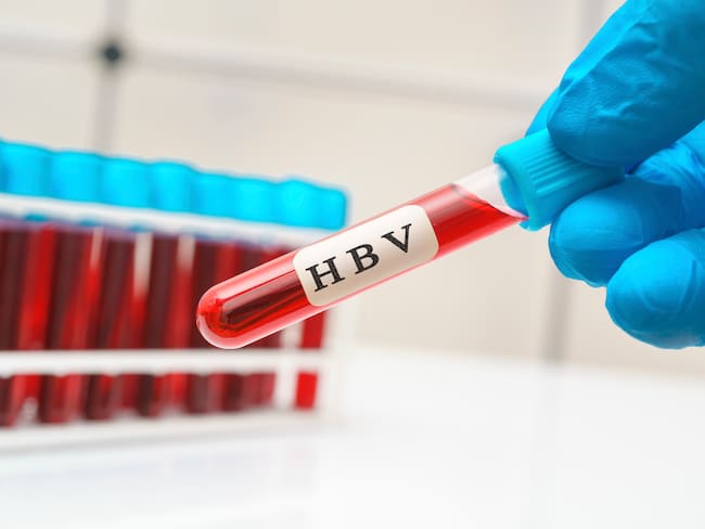 Hepatitis, imagen de referencia. Foto: Getty Images