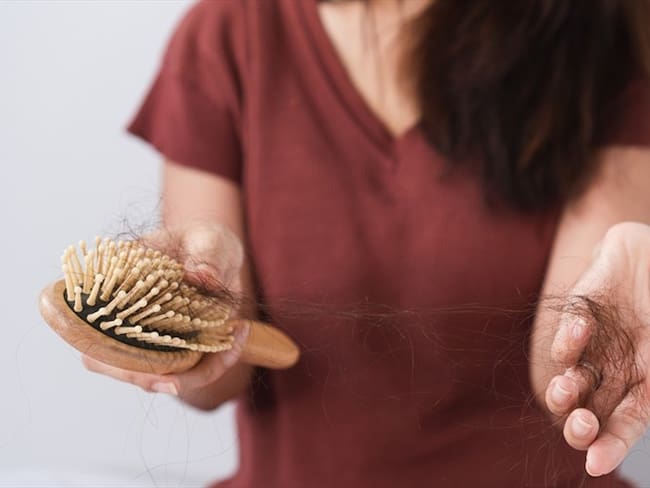 Caída de cabello post-COVID: ¿Qué lo causa y cómo puede tratarse?. Foto: Getty Images