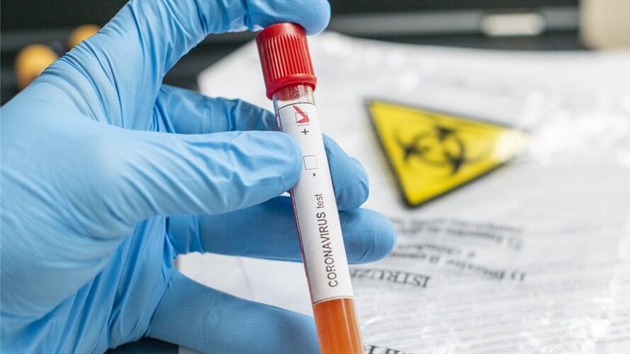 Carlos Alberto Ospina contó en Sigue La W el drama que ha vivido su familia por cuenta de la pandemia. . Foto: Getty Images