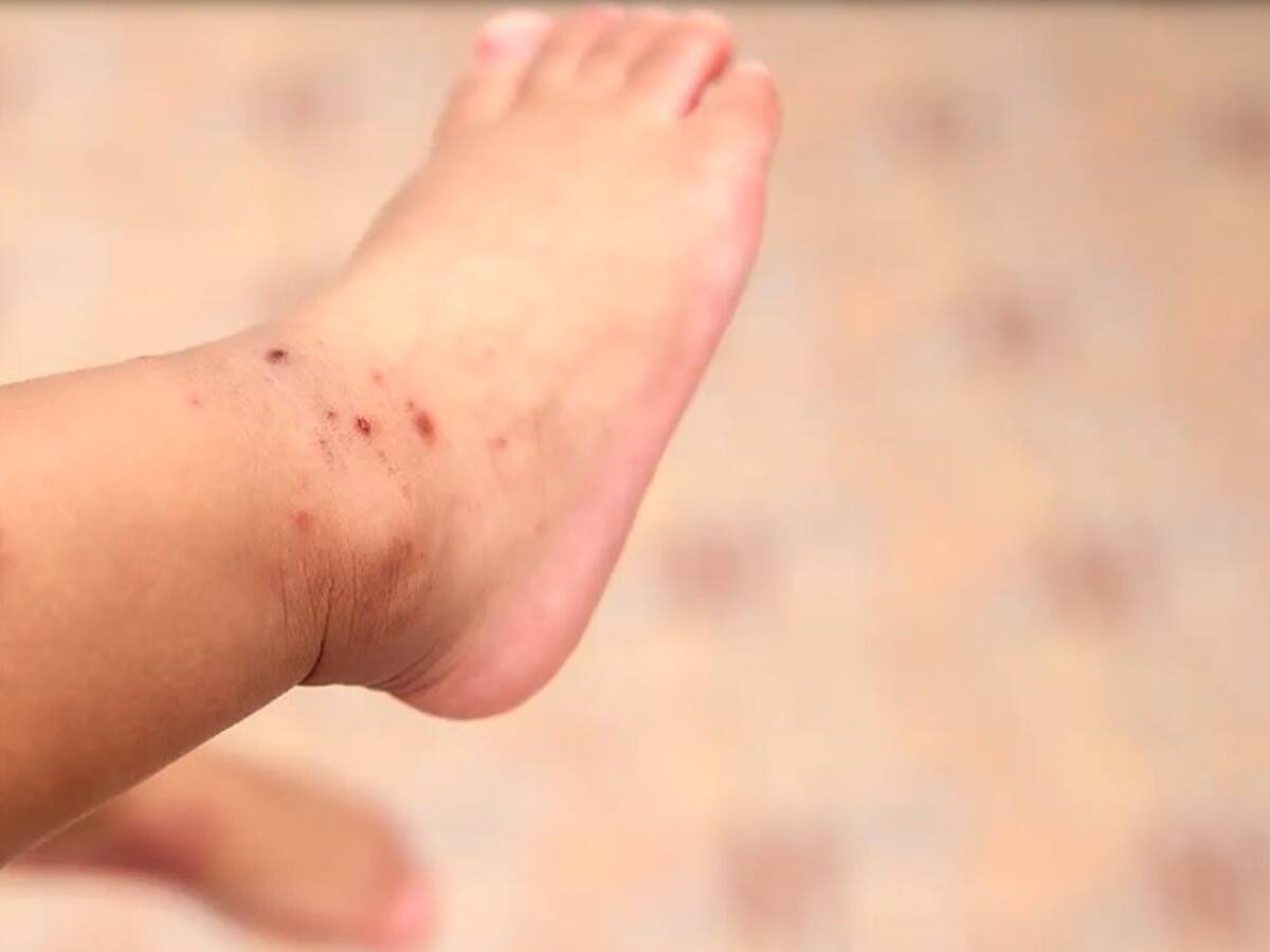 Alerta en guarderías y jardines infantiles de Manizales por presencia de un virus