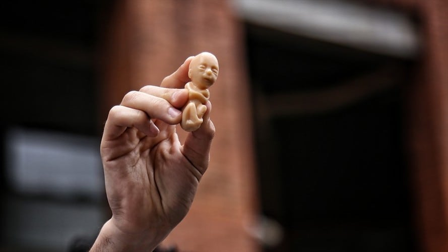 Pese a recusaciones, no se frena la discusión sobre el aborto en la Corte. Foto: Colprensa