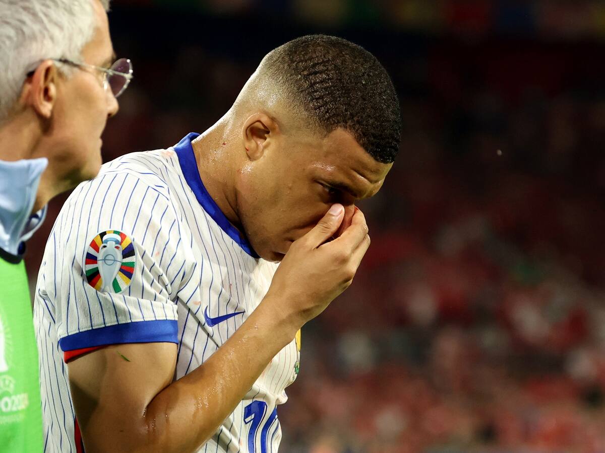 Mbappé se reincorpora con Francia y jugará con máscara los próximos partidos de Eurocopa