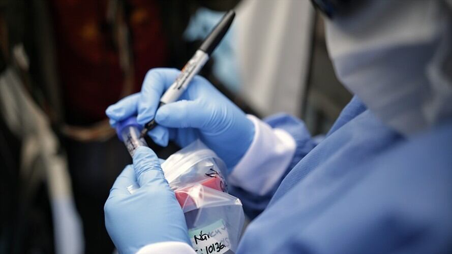 Casos de COVID-19 en Colombia. Foto: Colprensa