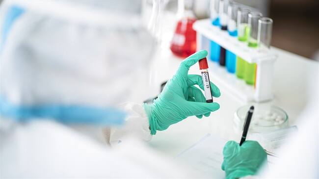 Casos de Coronavirus. Foto: Getty Images