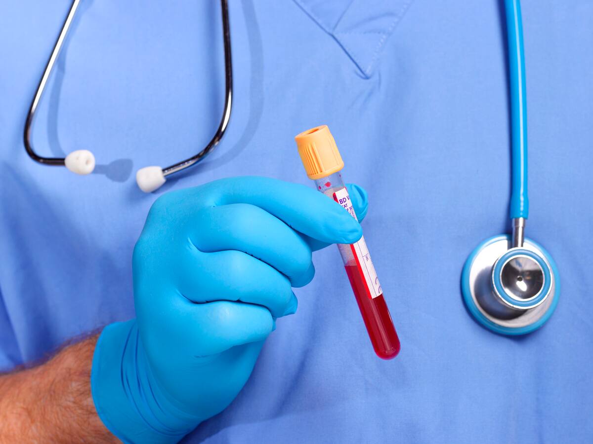 ¿En qué casos son preocupantes las hemorragias? Experto habla sobre las causas