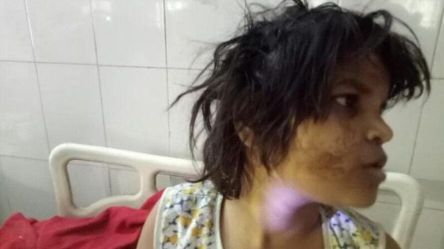 Hallan a niña viviendo con monos en bosque de India. Foto: BBC Mundo
