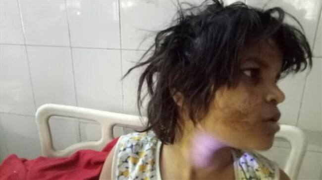 Hallan a niña viviendo con monos en bosque de India. Foto: BBC Mundo