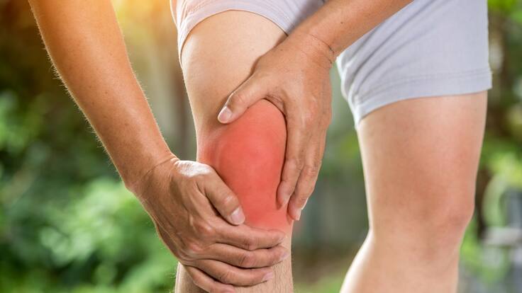 ¿Qué es la artrosis? Experto reveló causas, recomendaciones y más