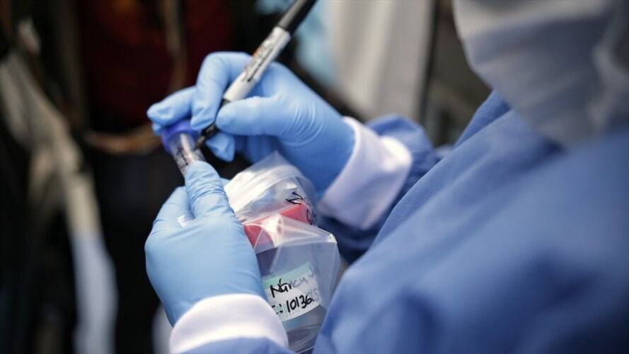 Casos de COVID-19 en Colombia. Foto: Colprensa