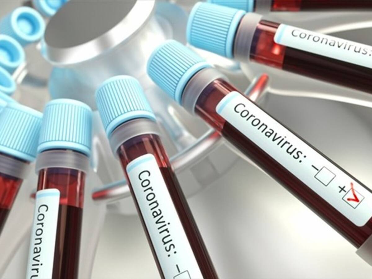 Piden al Gobierno Nacional instalar laboratorio en Boyacá para pruebas de Covid -19