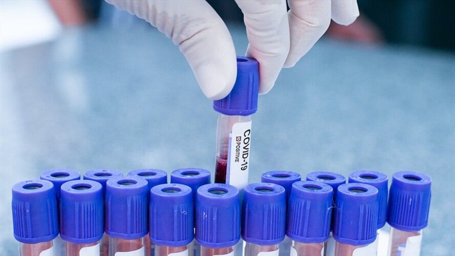 Casos de COVID-19 en Colombia. Foto: Getty Images