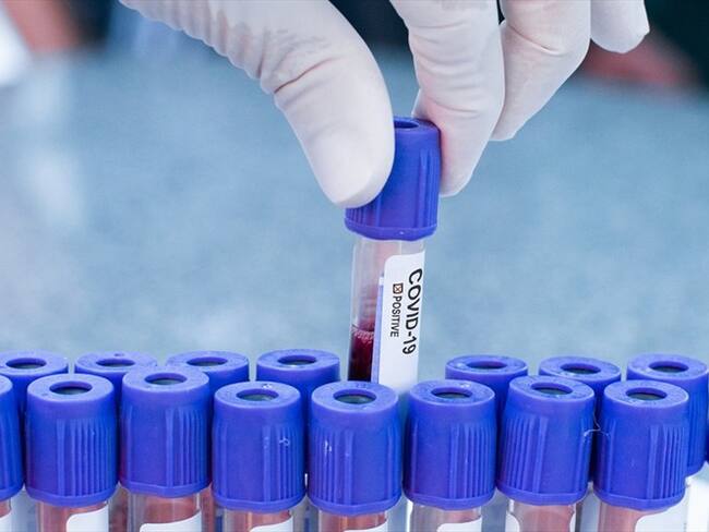 Casos de COVID-19 en Colombia. Foto: Getty Images