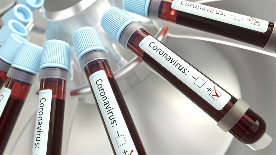 Medidas y recomendaciones para contener propagación de Coronavirus: habla el Gobierno . Foto: Getty Images