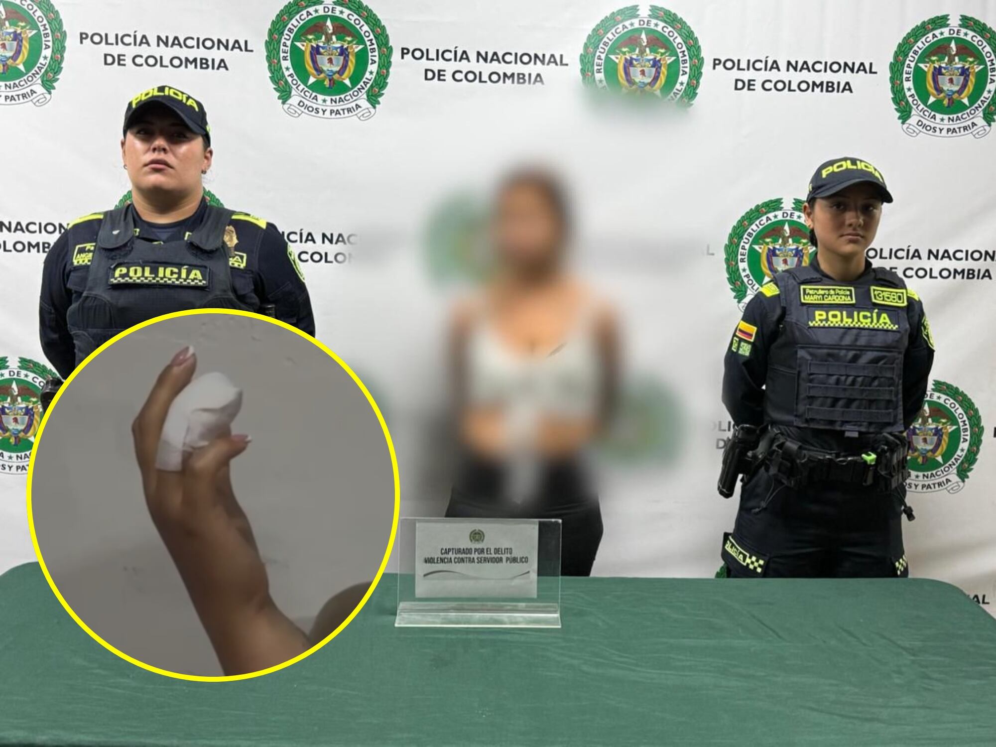 Capturan a mujer que mordió a una patrullera en medio de una requisa en Bogotá