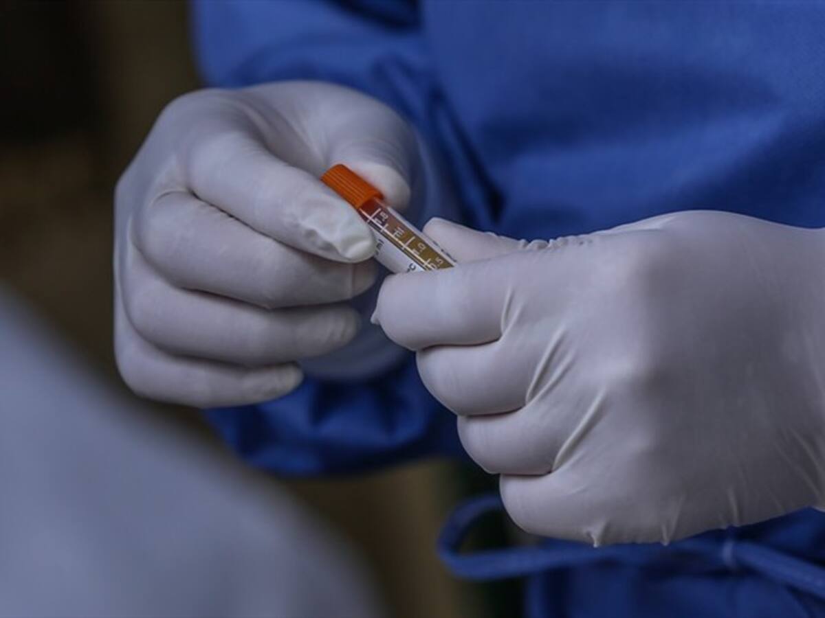 Santa Marta reporta nuevos casos de COVID-19 en trabajadores de la salud