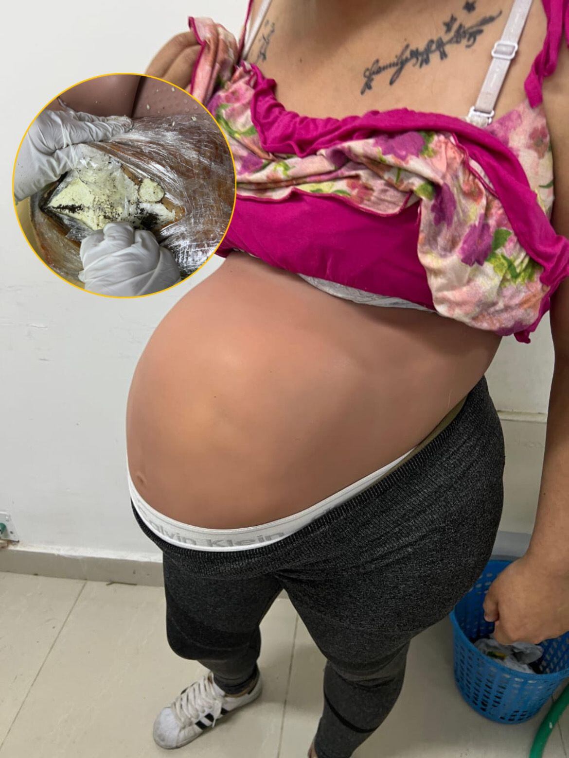 Según las autoridades, los vientres falsos son adquiridos por redes narcotraficantes en el extranjero por un valor cercano a los tres millones de pesos. Foto: Policía.