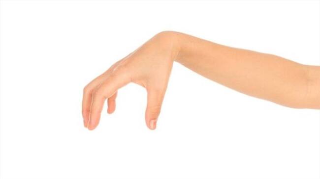 Quienes padecen la condición dicen que su mano no les obedece.. Foto: BBC Mundo