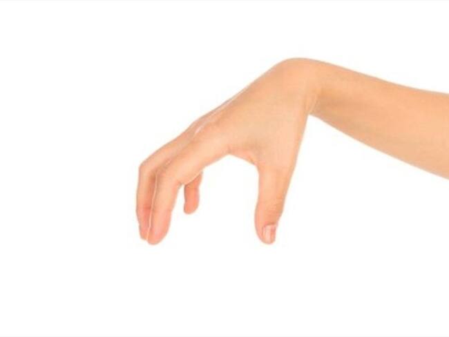 Quienes padecen la condición dicen que su mano no les obedece.. Foto: BBC Mundo