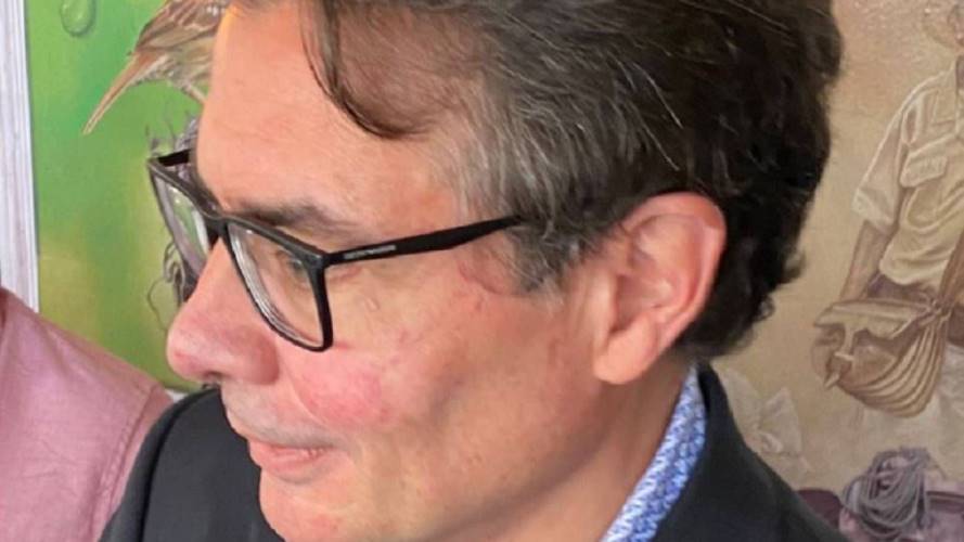 Precandidato presidencial y exministro de Salud, Alejandro Gaviria. Crédito: W Radio.