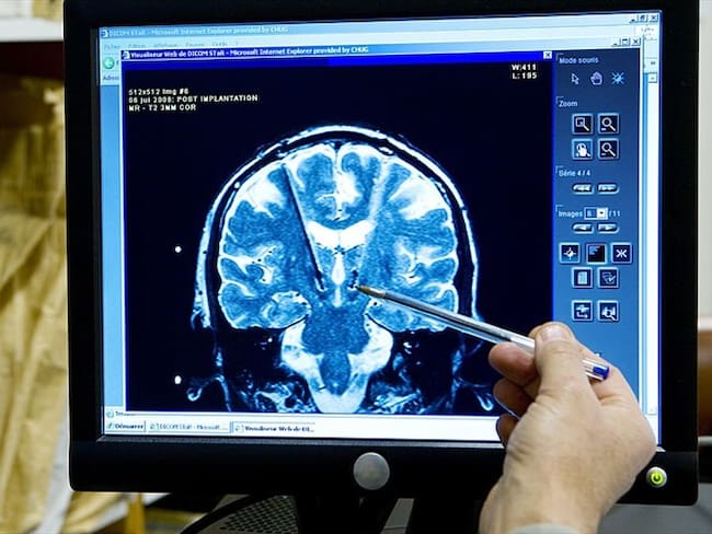 Los implantes cerebrales que buscan que nos comuniquemos telepáticamente
