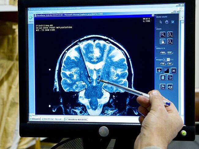 Los implantes cerebrales que buscan que nos comuniquemos telepáticamente