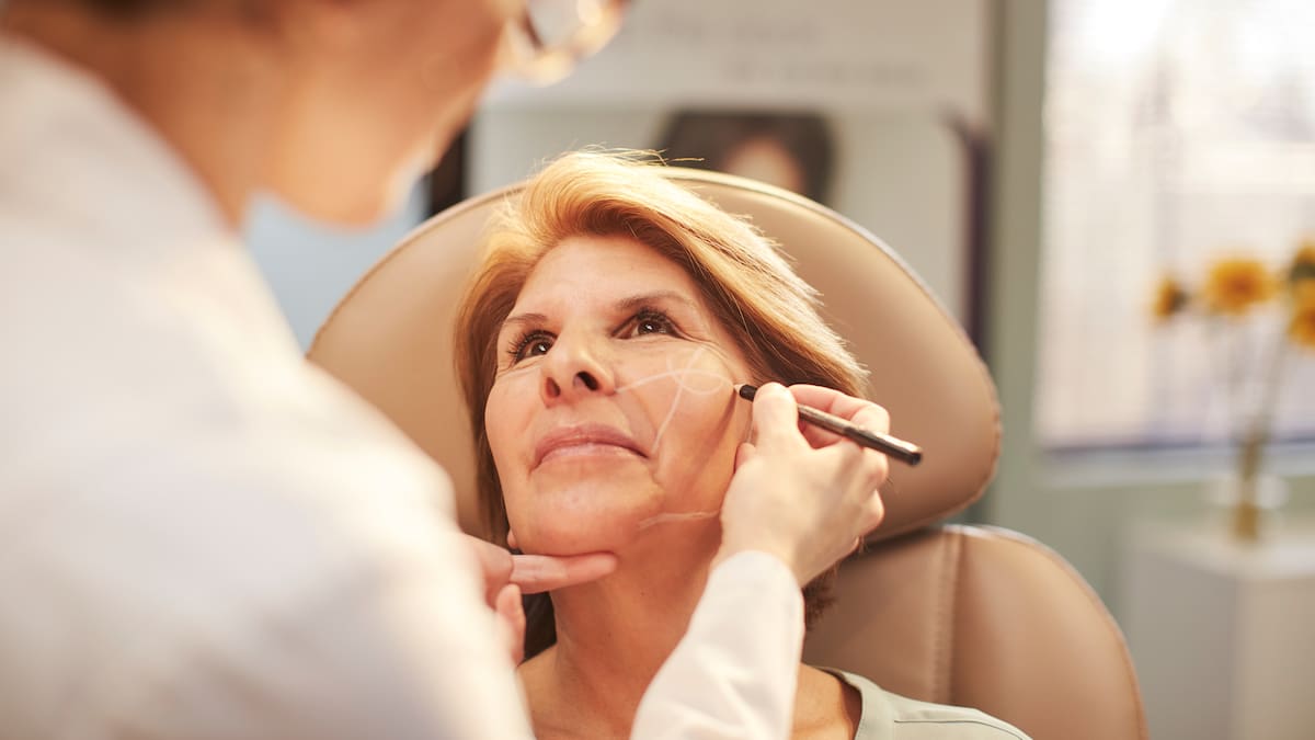 ¿Es posible estirarse la piel de la cara sin cirugía? Profesional explicó nuevo procedimiento