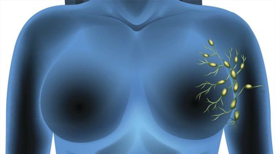 Algunos de los ganglios centinelas del sistema linfático están ubicados alrededor de las glándulas mamarias en hombres y mujeres.. Foto: BBC Mundo