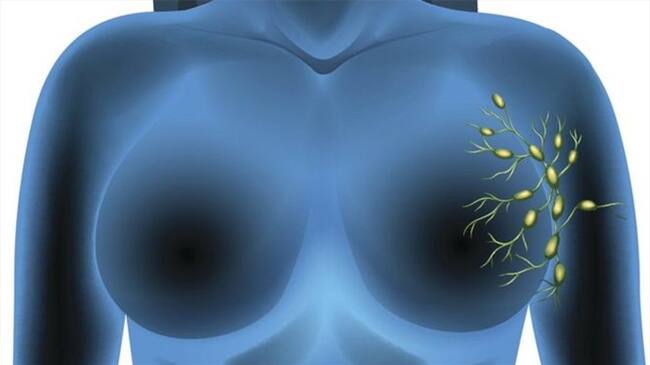 Algunos de los ganglios centinelas del sistema linfático están ubicados alrededor de las glándulas mamarias en hombres y mujeres.. Foto: BBC Mundo