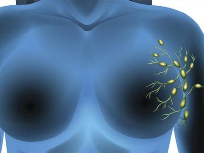 Algunos de los ganglios centinelas del sistema linfático están ubicados alrededor de las glándulas mamarias en hombres y mujeres.. Foto: BBC Mundo