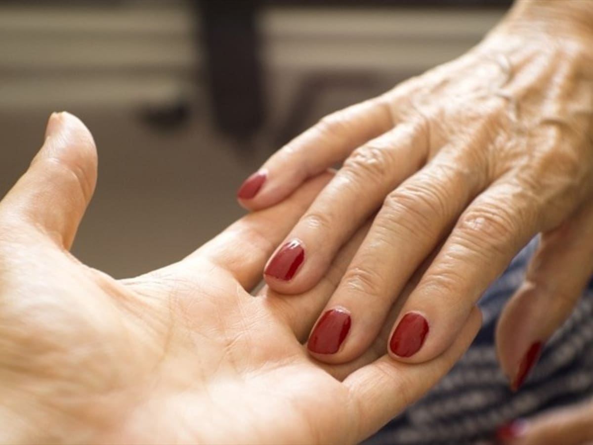 Joven de 16 años luce como una mujer de 50 por rara enfermedad genética