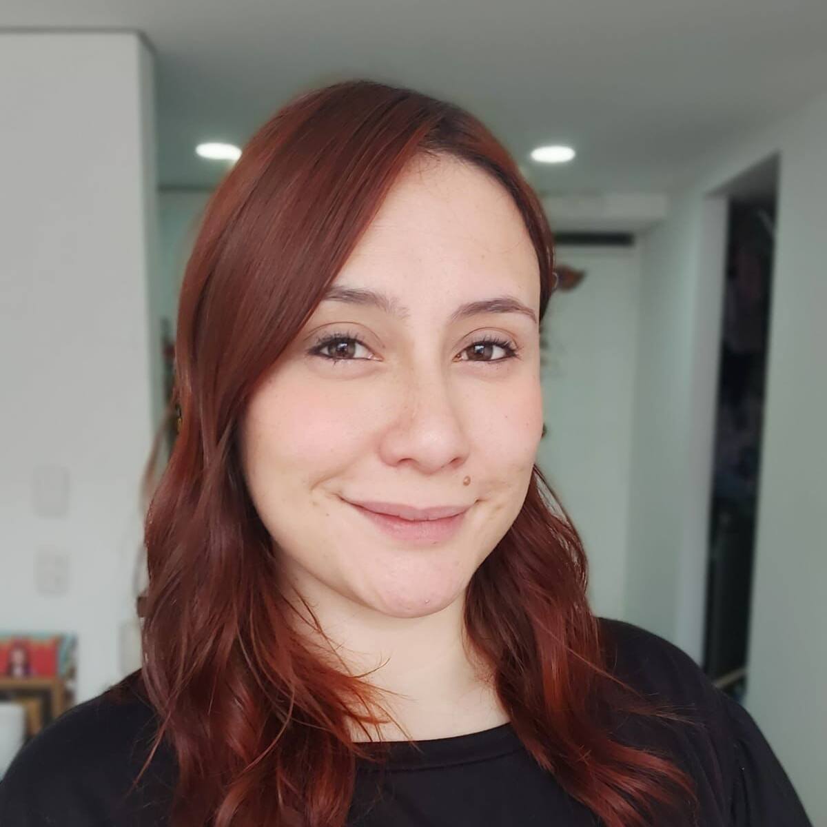 ¿Cómo es vivir con epilepsia? Coach en Medicina Funcional dio su testimonio
