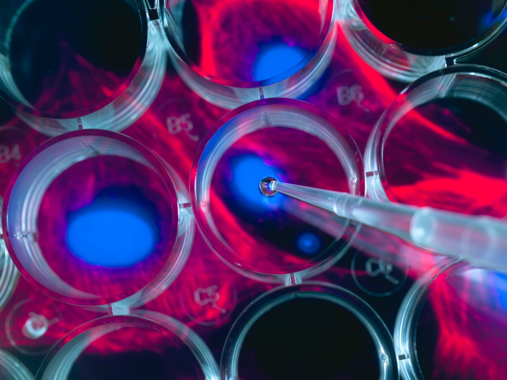 Imagen de referencia / Getyy Images