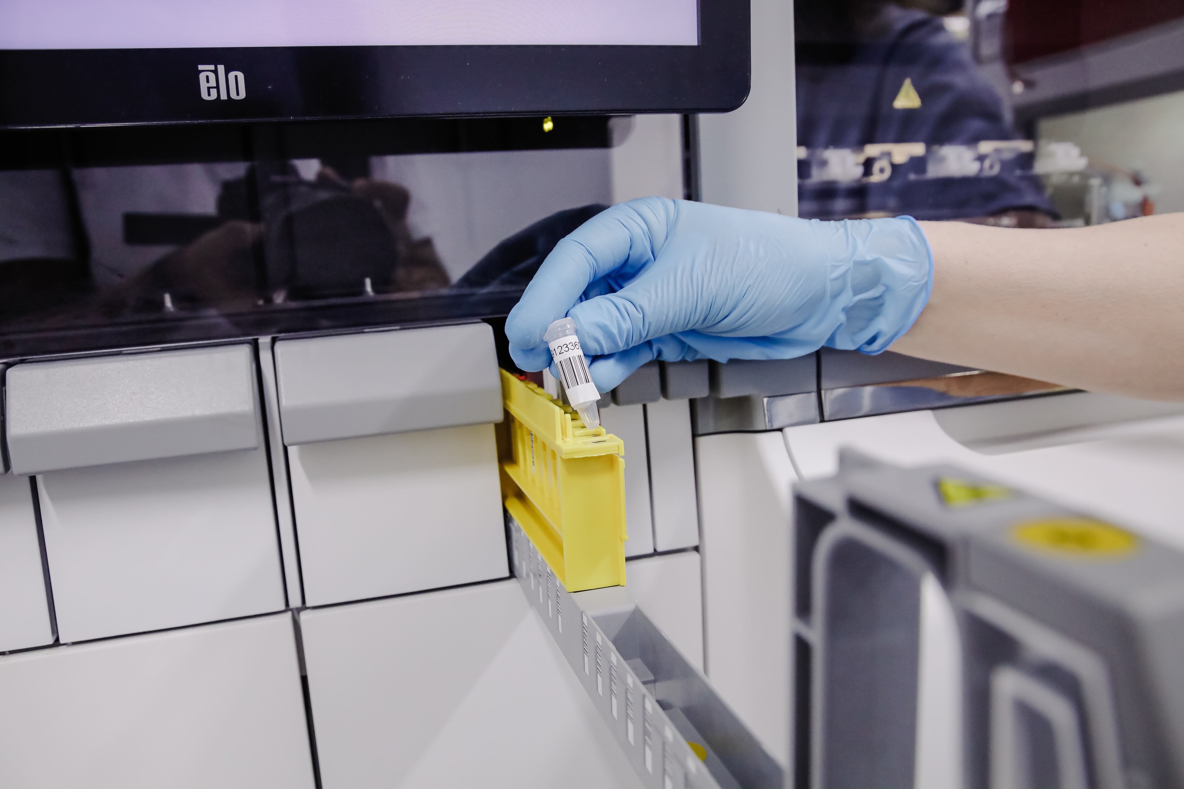 Imagen de referencia de la extracción de material genético del virus viruela del mono. Foto de Carlos Lujan / Getty Images