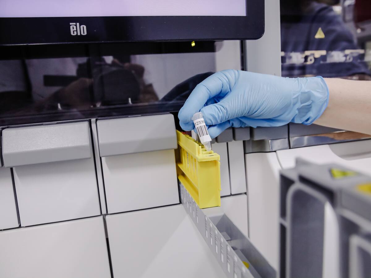 OMS: La viruela del mono no es por el momento una emergencia sanitaria internacional