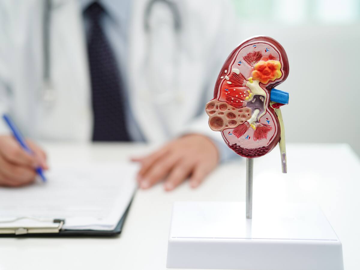 ¿Cómo cuidar los riñones? Médico habló sobre los factores de riesgo de enfermedades renales