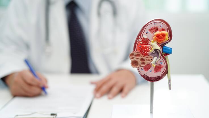 ¿Cómo cuidar los riñones? Médico habló sobre los factores de riesgo de las enfermedades renales