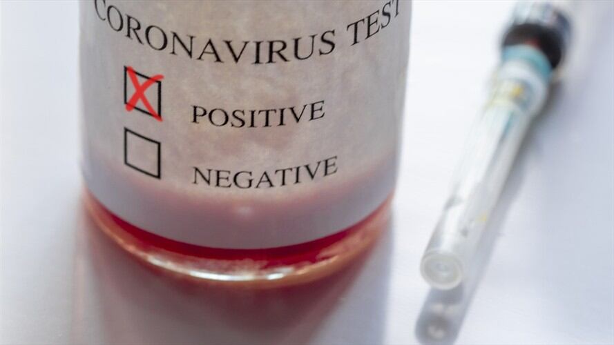 educe de manera significativa los efectos dañinos del virus al tratar el tejido humano infectado. Foto: Getty Images