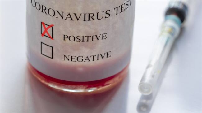 educe de manera significativa los efectos dañinos del virus al tratar el tejido humano infectado. Foto: Getty Images