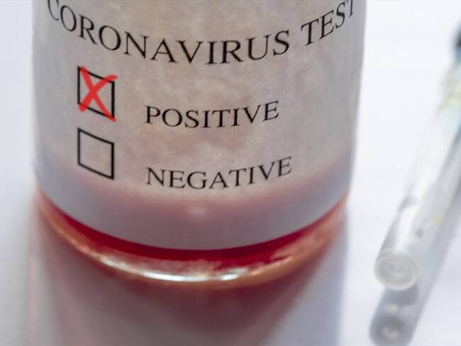 educe de manera significativa los efectos dañinos del virus al tratar el tejido humano infectado. Foto: Getty Images