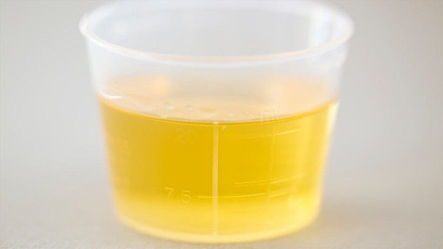 John de Pass inició está particular dieta para quitarse un dolor crónico que padecía hace años.. Foto: Getty Images